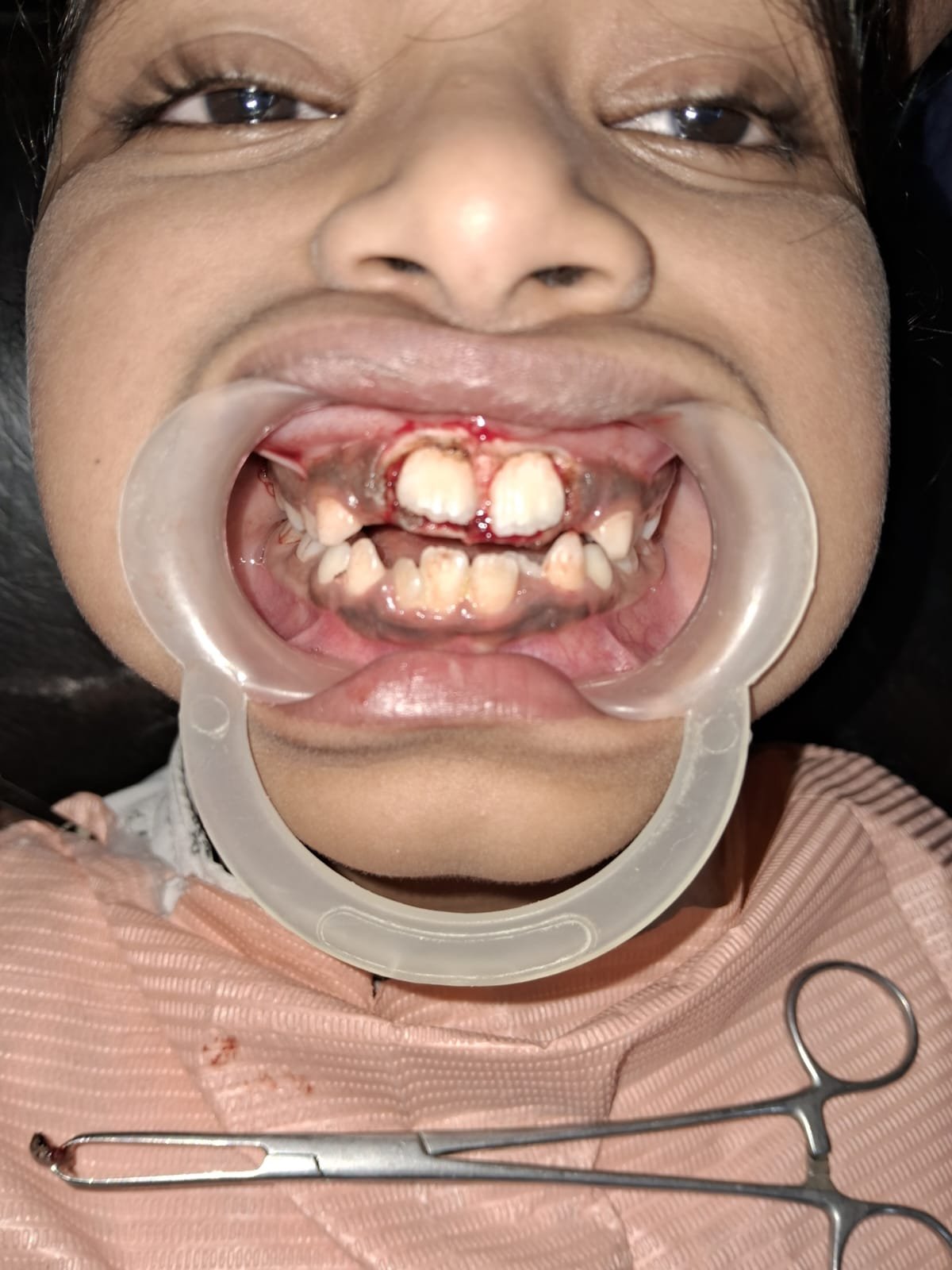 Before dental treatment